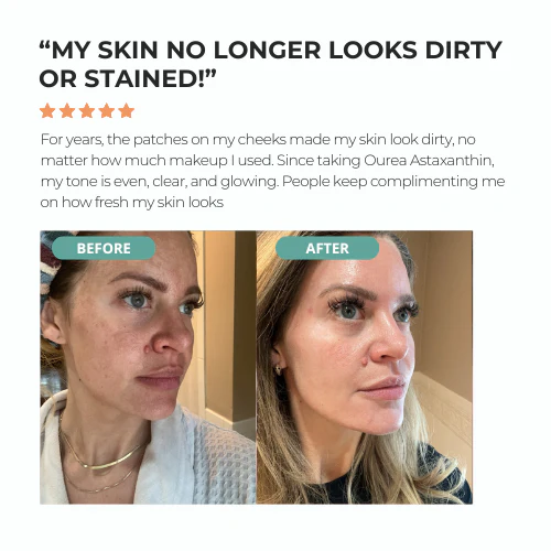 Ourea Astaxanthin - Image 4