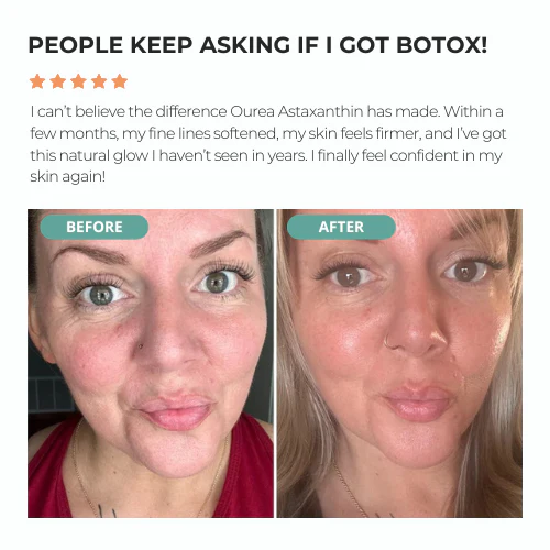 Ourea Astaxanthin – Nature’s Most Powerful Antioxidant - Image 5