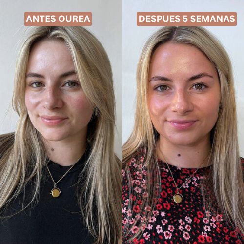 Ourea Gotas Bronceadoras 2.0 - Image 4
