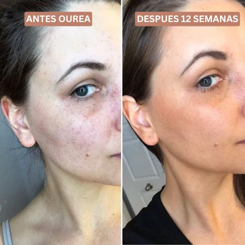 Ourea Gotas Bronceadoras 2.0 - Image 5