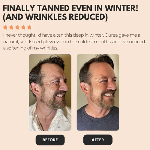 Ourea - Carotenoids Tanning Blend - O7 - Image 7